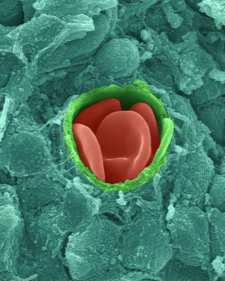 Human Red Blood Cells In A Capillary #2 Photograph by Dennis Kunkel Microscopy/science Photo Library