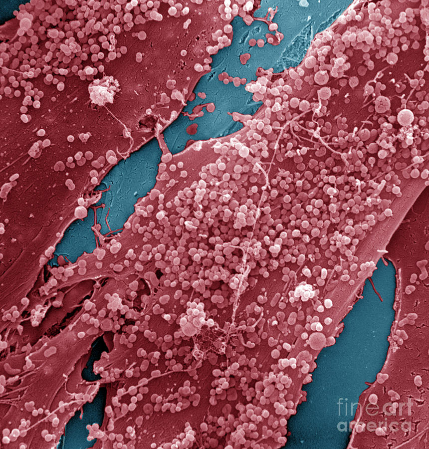 Human Skin Cell Sem #2 Photograph by David M. Phillips