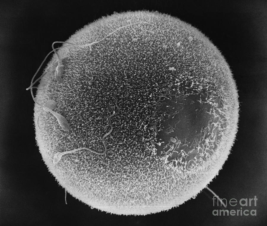 Human Sperm Fertilizing Hamster Egg Sem #2 Photograph by David M. Phillips / The Population Council