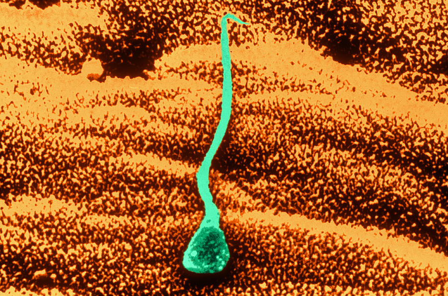 Human Sperm In Uterus #2 Photograph by John Watney