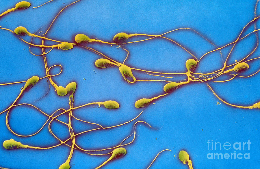 Human Sperm, Sem #2 Photograph by David M. Phillips