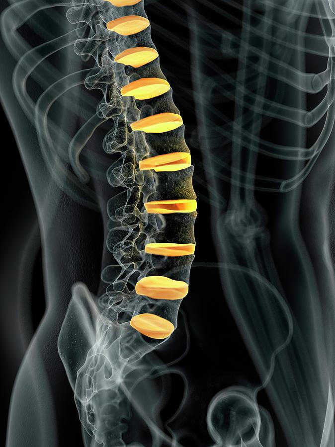 Human Spinal Intervertebral Discs Photograph By Sciepro Fine Art America