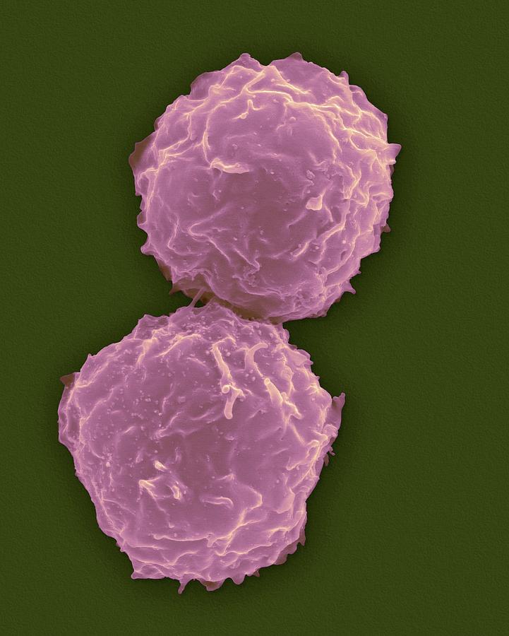 Human Stem Cells From Bone Marrow #2 Photograph by Dennis Kunkel Microscopy/science Photo Library