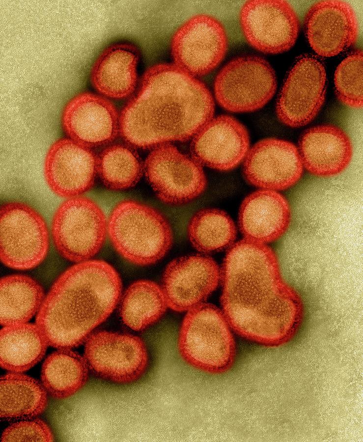 Human Swine Flu Virus H1n1 #2 Photograph by Dennis Kunkel Microscopy/science Photo Library