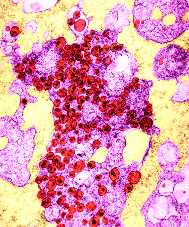 Human T-lymphocyte Showing Hiv #2 Photograph by Kwangshin Kim