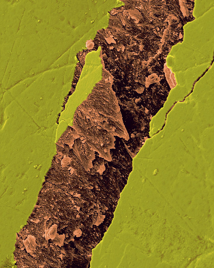 Human Tooth Fractured Enamel #2 Photograph by Dennis Kunkel Microscopy/science Photo Library