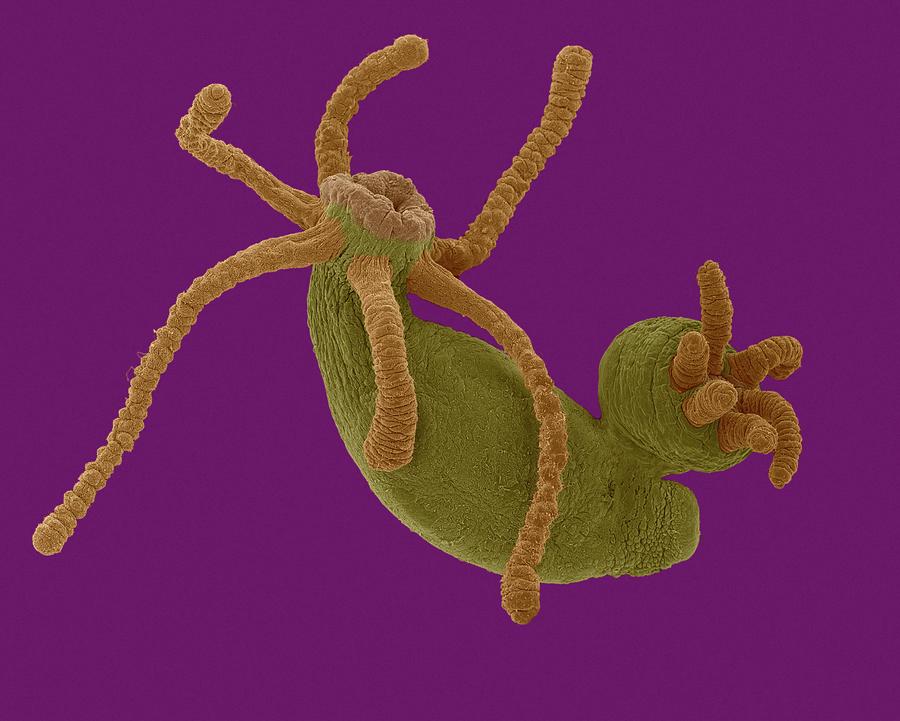 Hydra Sp. Budding (cnidarian) #2 Photograph by Dennis Kunkel Microscopy/science Photo Library