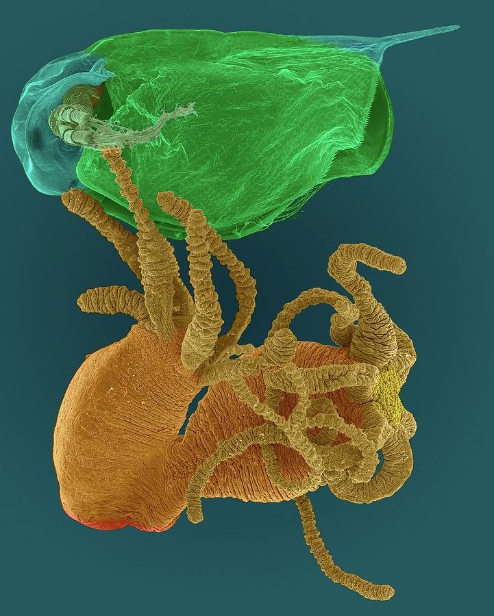 Hydra Sp. Capturing Daphnia Sp. #2 Photograph by Dennis Kunkel Microscopy/science Photo Library