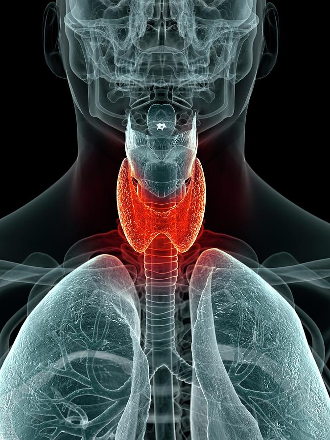 inflamed-thyroid-photograph-by-sciepro-pixels