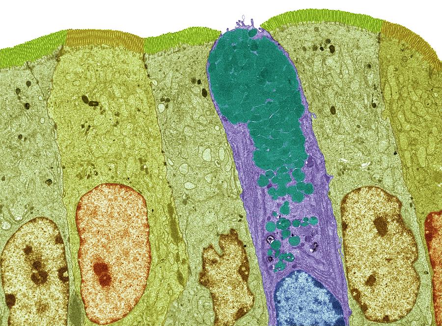 Intestinal Lining #2 Photograph by Steve Gschmeissner/science Photo Library