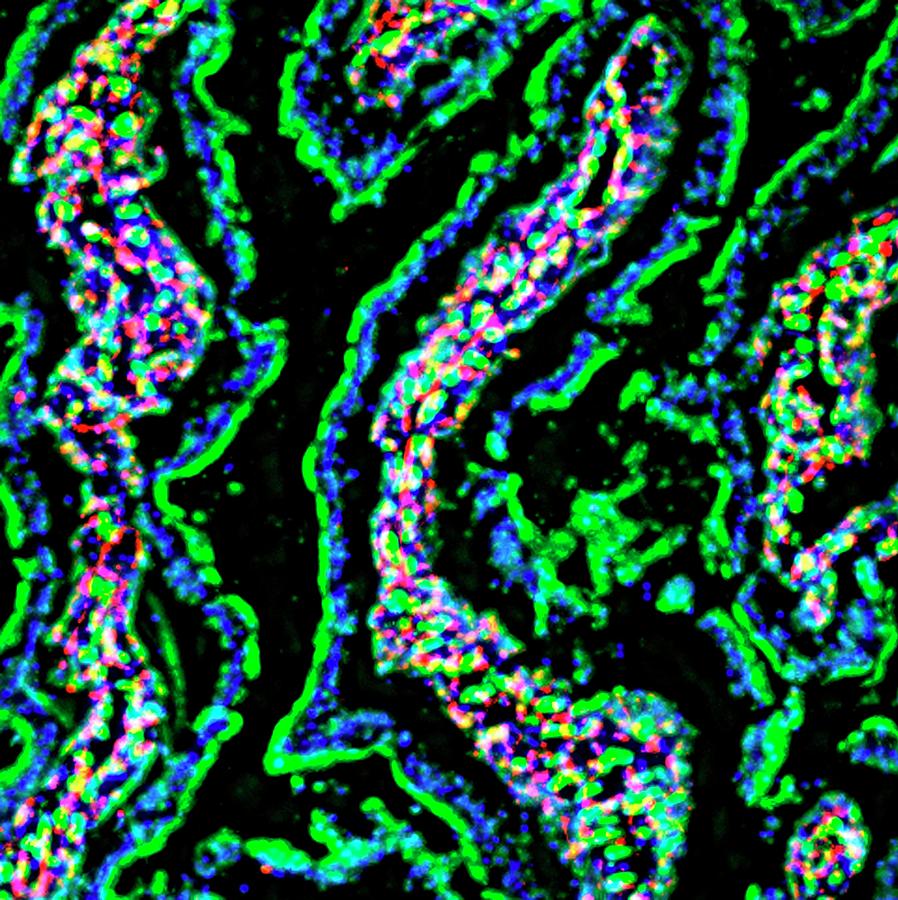 Intestinal Villi #2 Photograph by R. Bick, B. Poindexter, Ut Medical School/science Photo Library