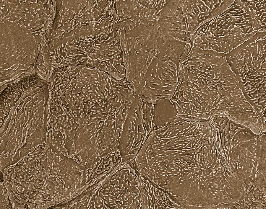 Keratinocyte skin cells, SEM Photograph by Science Photo Library