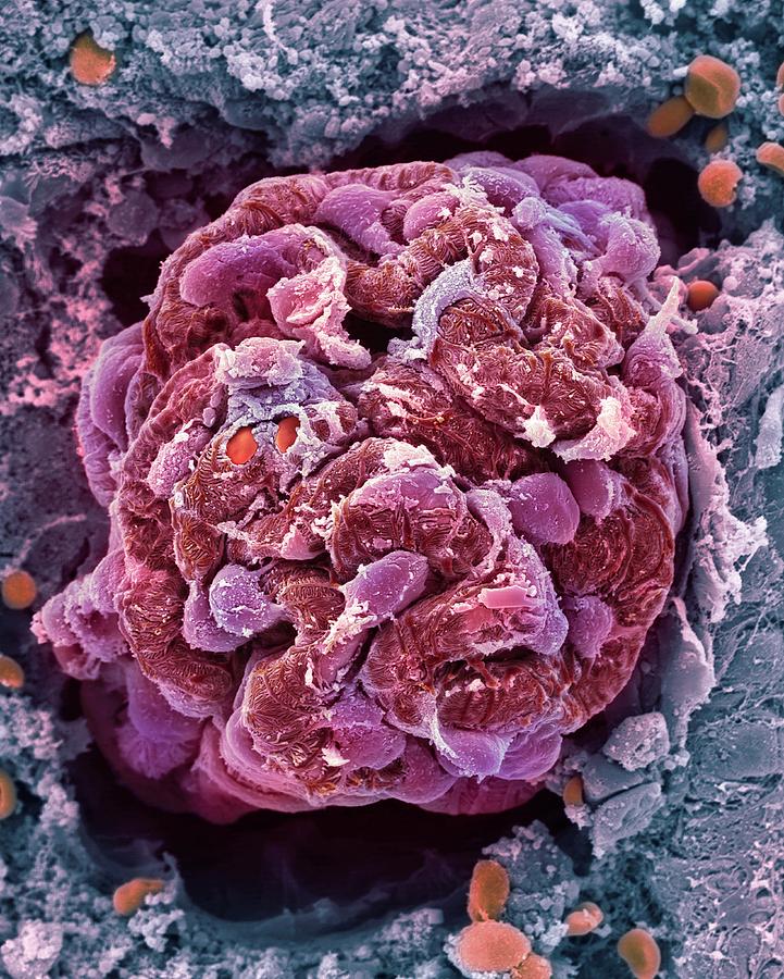 Kidney Glomerulus Photograph by Dennis Kunkel Microscopy/science Photo