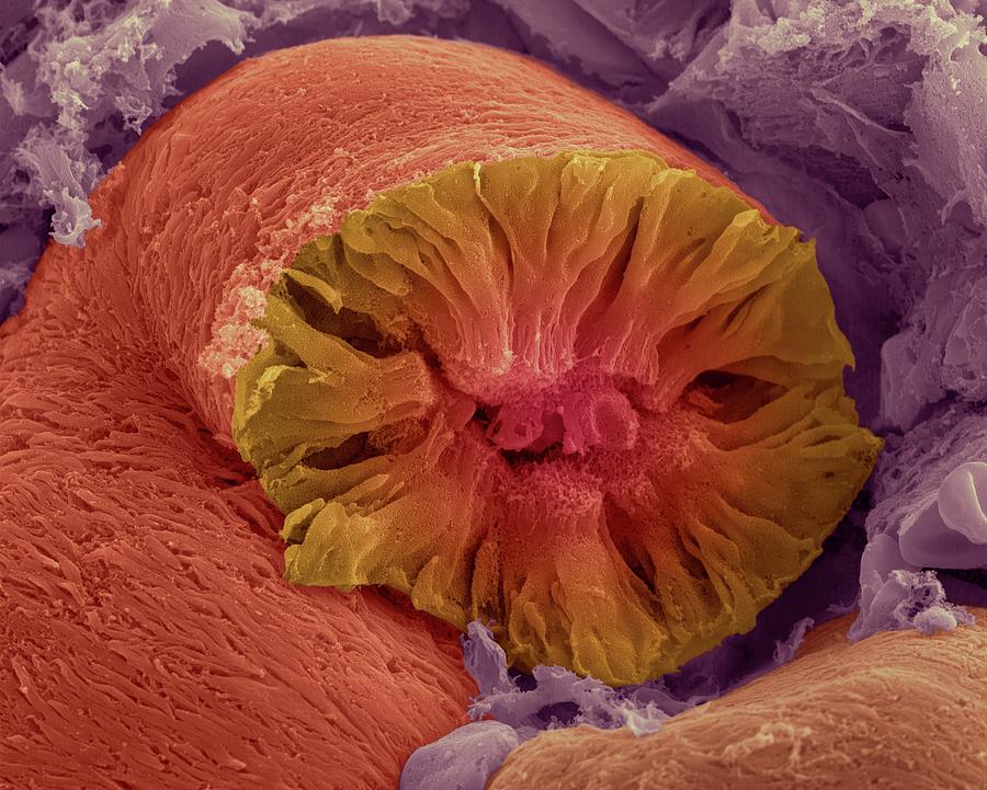 Kidney Tubule #2 Photograph by Dennis Kunkel Microscopy/science Photo Library
