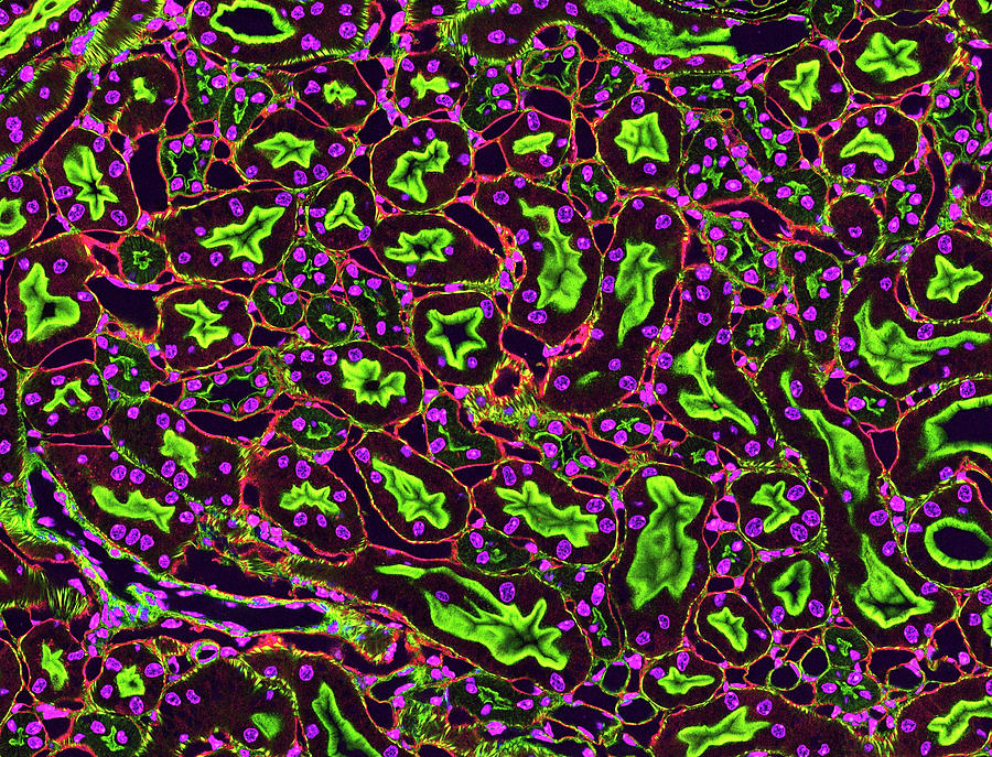 Kidney Tubules In Section #2 Photograph by Thomas Deerinck, Ncmir