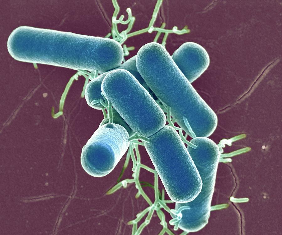 Lactobacillus Photograph - Lactobacillus Bacteria #2 by Science Photo Library