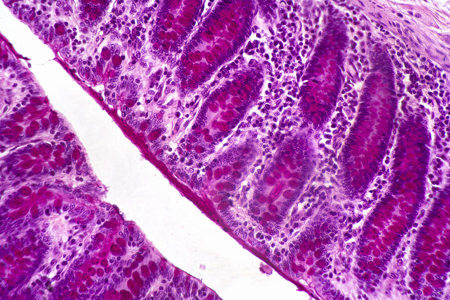 large intestine histology slides