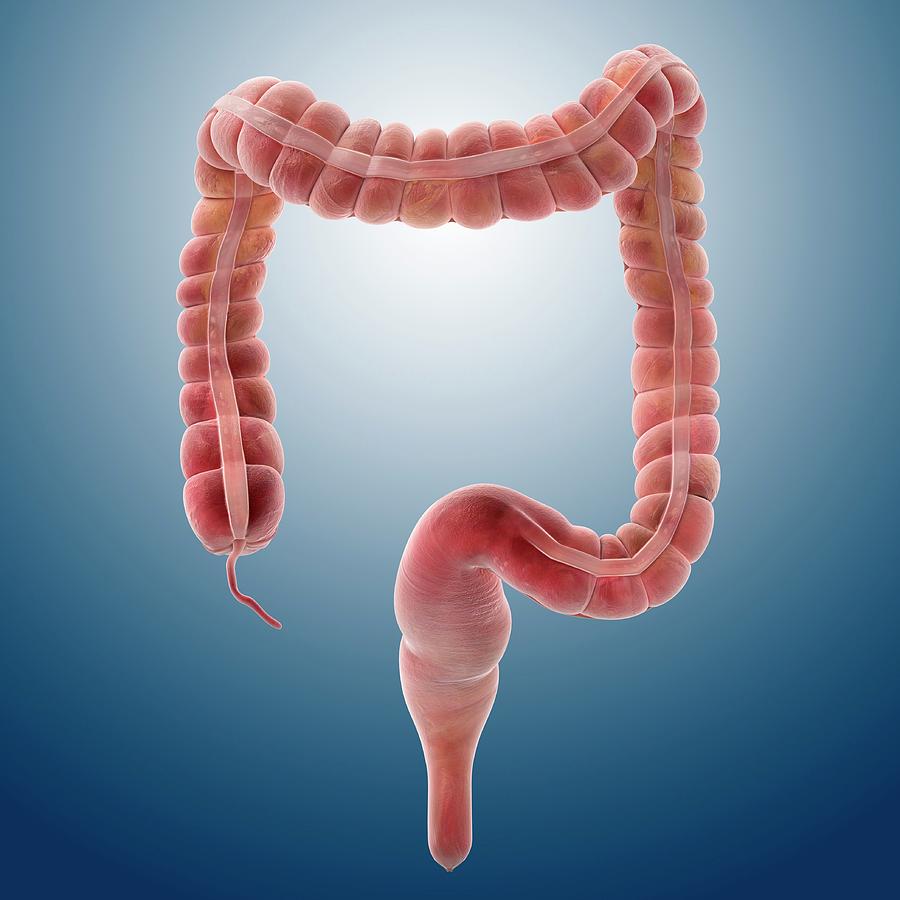 Large Intestine Photograph - Large Intestine #2 by Springer Medizin