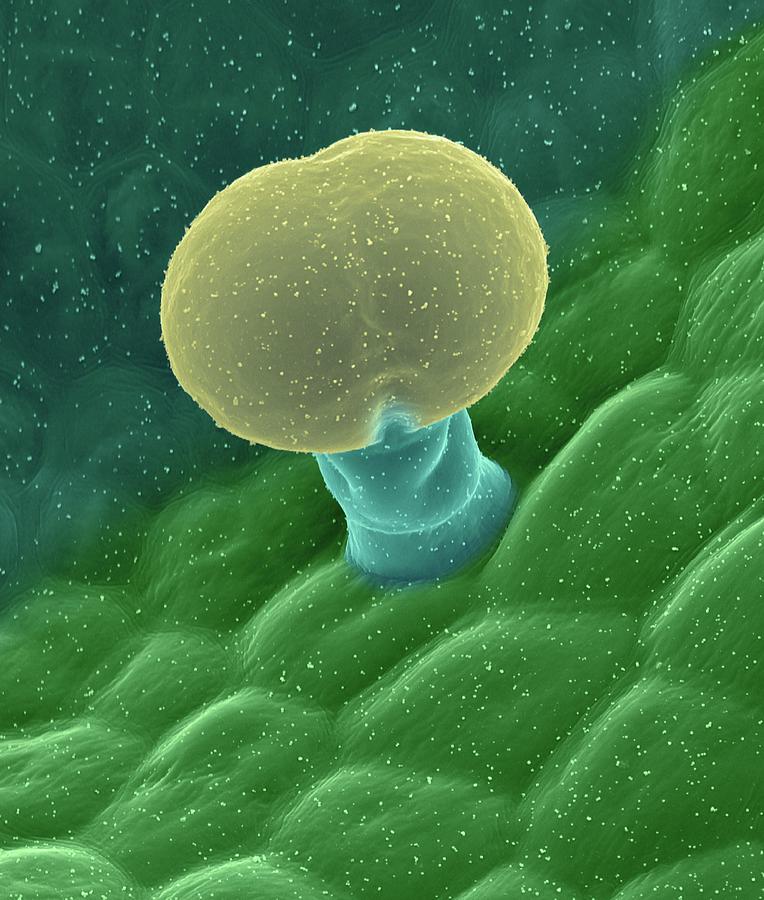 Plant Leaf Trichome (hibiscus Sp.) Photograph by Dennis Kunkel