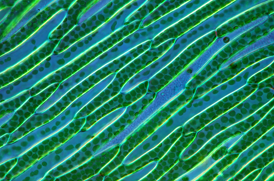 Leaf Tissue Of Sphagnum Moss, Lm #2 Photograph by Marek Mis