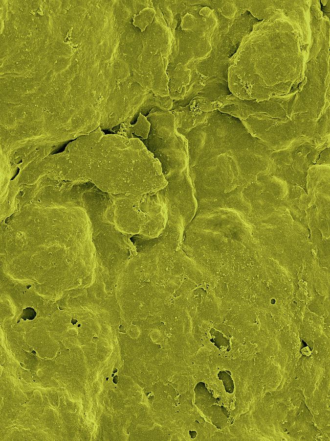 Lemon Peel Surface #2 Photograph by Science Photo Library Lemon Peel Surface #2 Photograph by Science Photo Library