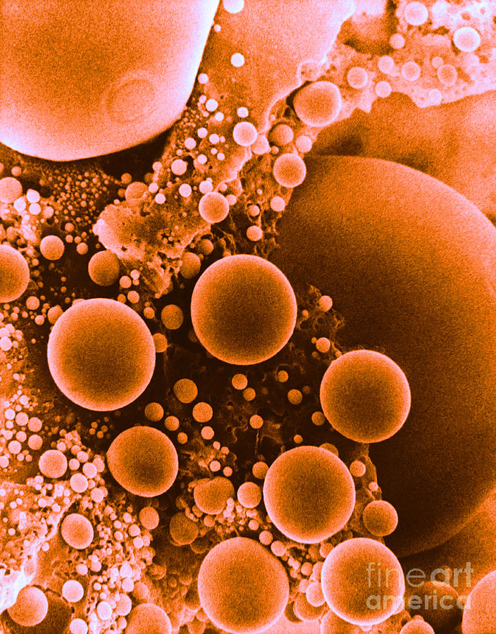 Lipid Droplets, Sem #2 Photograph by David M. Phillips