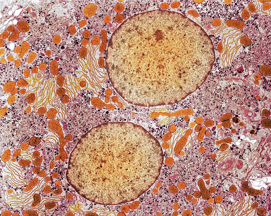 Liver Cell #2 Photograph by Medimage/science Photo Library
