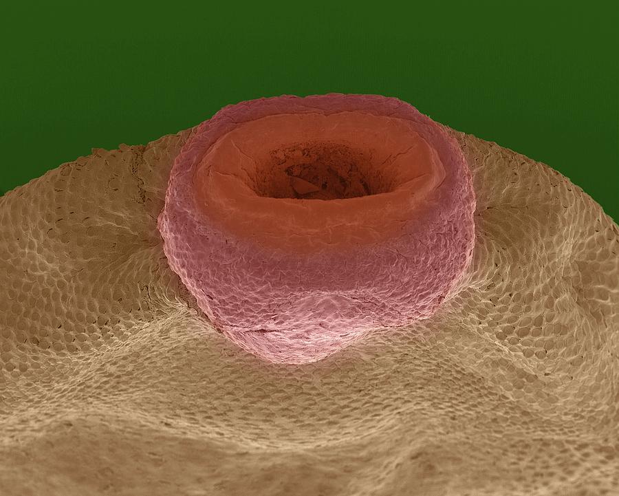 Liver Fluke (trematode) #2 Photograph by Dennis Kunkel Microscopy/science Photo Library