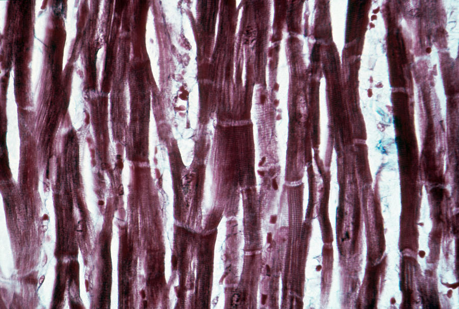 Lm Of Cardiac Muscle #2 Photograph by Michael Abbey