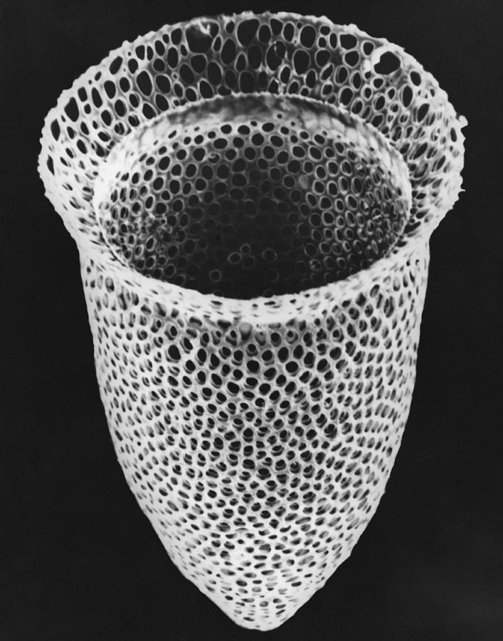 Lorica Shell Of Tintinnid Ciliate Sem #2 Photograph by Greg Antipa