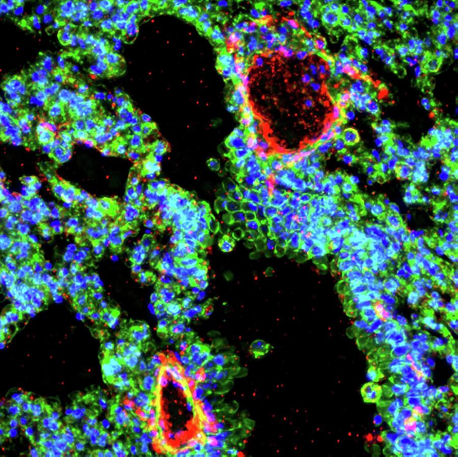 Lung Bronchiole Photograph by R. Bick, B. Poindexter, Ut Medical School ...