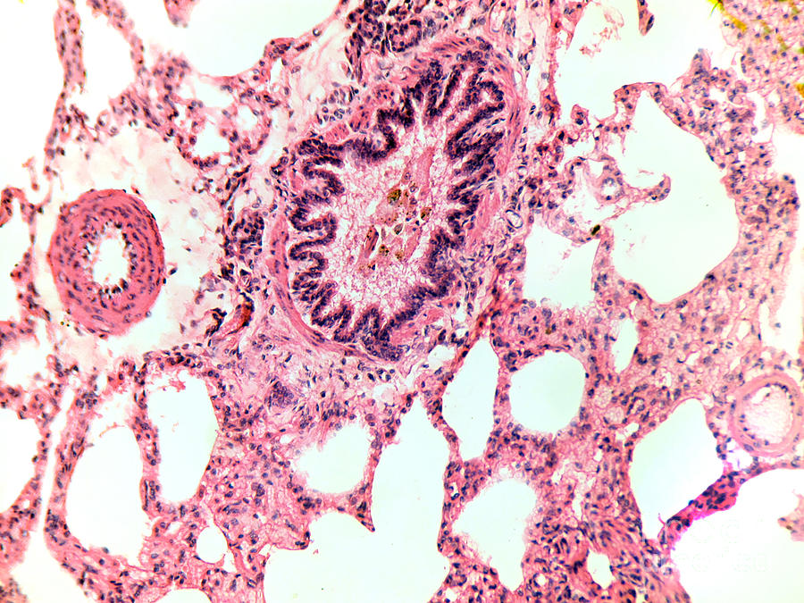 Lung Tissue Of A Cat Lm #2 Photograph by Garry DeLong