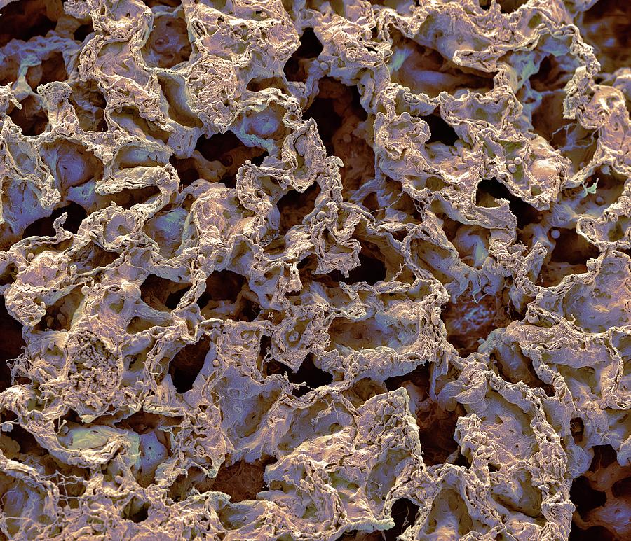 Lung Tissue #2 Photograph by Steve Gschmeissner/science Photo Library