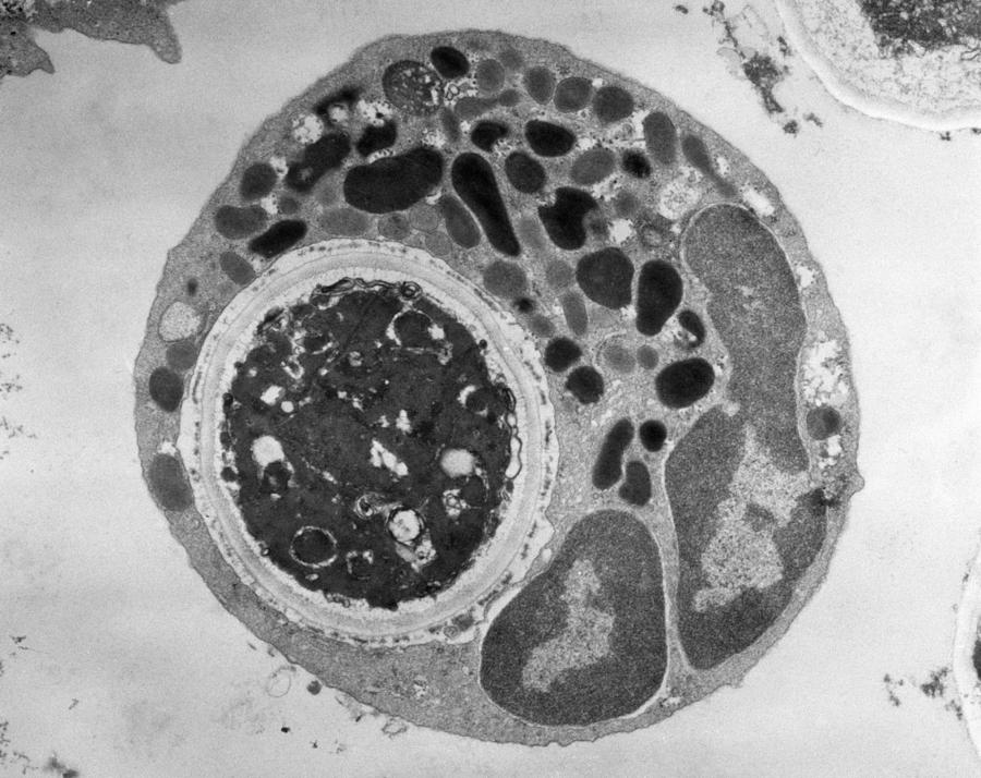 Lymphocyte Digesting Yeast Cell Tem #2 Photograph by Biology Pics