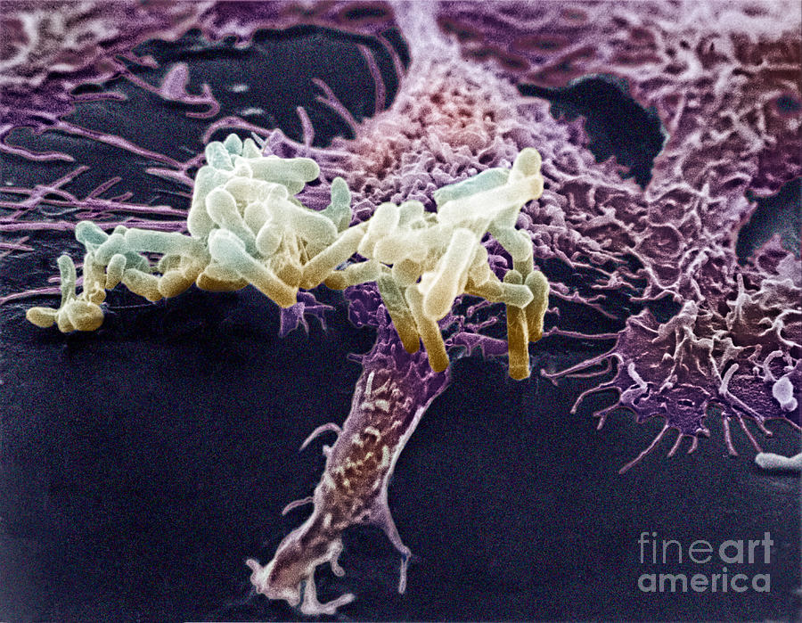 Macrophage Ingesting Pseudomonas #2 Photograph by David M. Phillips