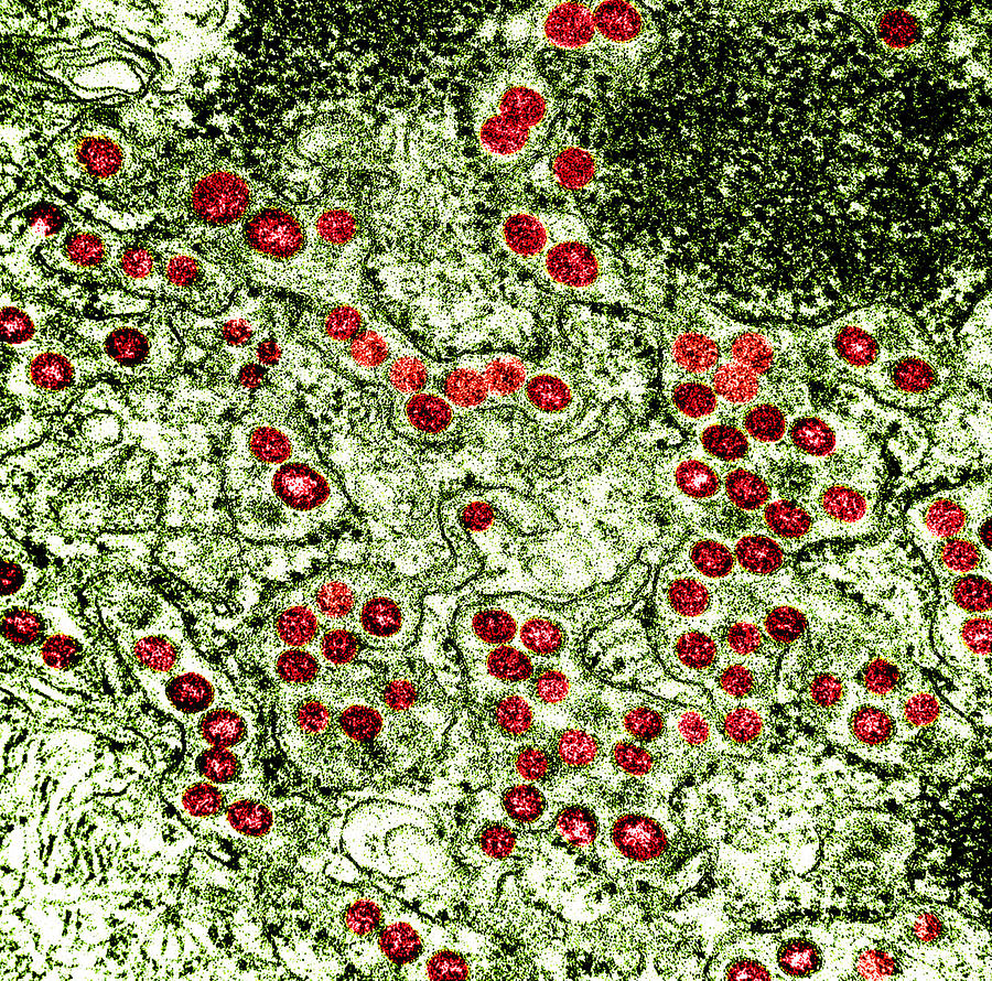 Mers Coronavirus Particles, Tem Photograph by Science Source - Fine Art ...