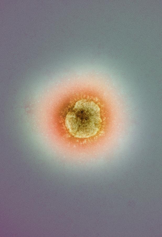 Middle East Respiratory Syndrome Coronavirus Photograph - MERS coronavirus, TEM #2 by Science Photo Library