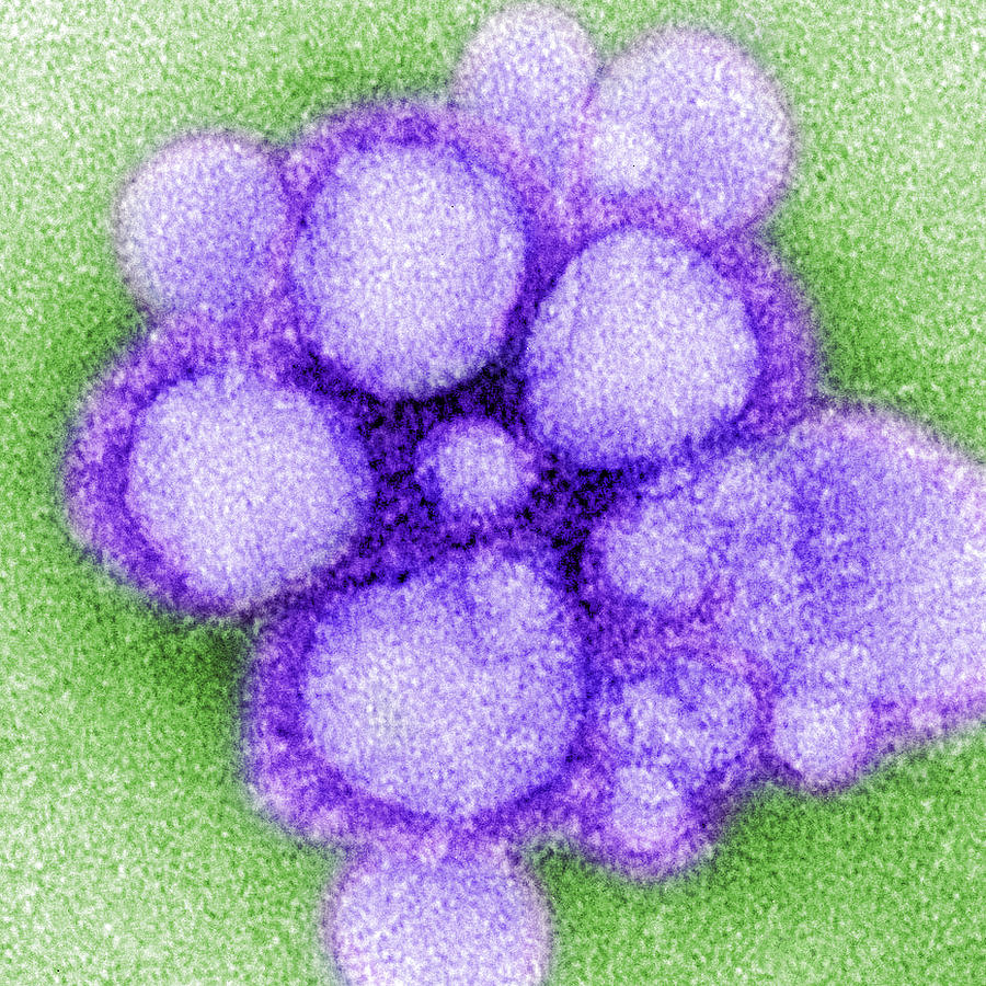 Mers-cov Middle East Respiratory #2 Photograph by Science Source