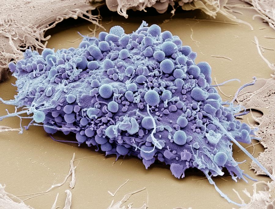 Scanning Electron Micrograph Photograph - Mesenchymal stem cell, SEM #2 by Science Photo Library