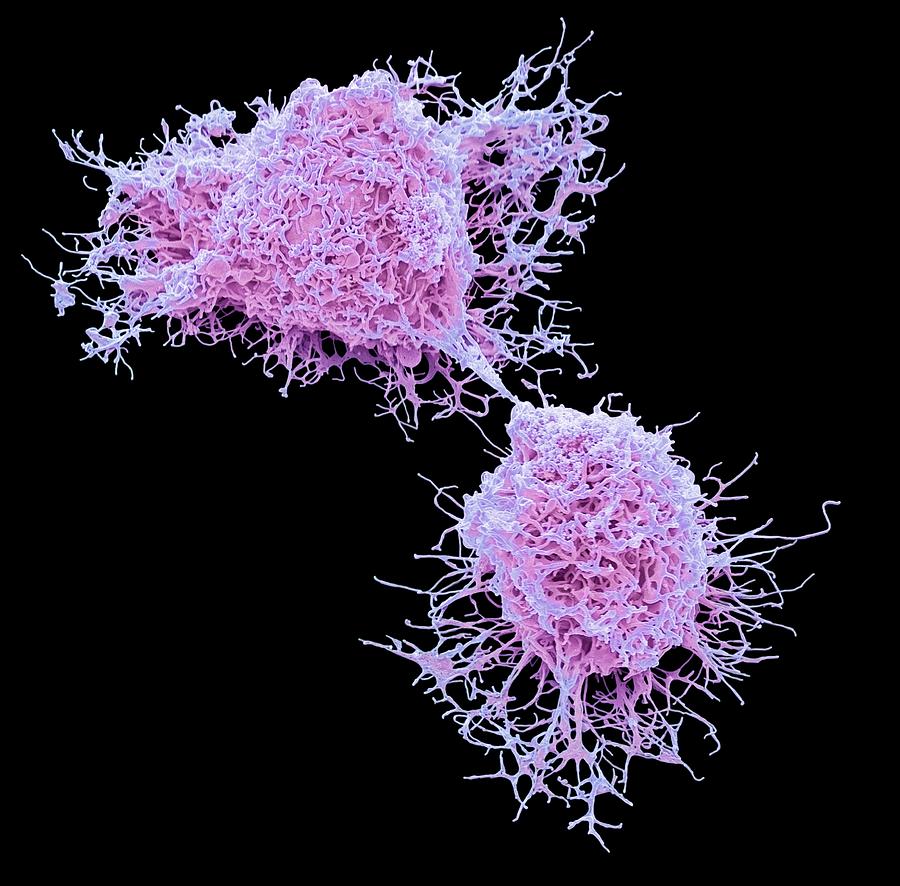 Mesenchymal Stem Cells #2 Photograph by Steve Gschmeissner
