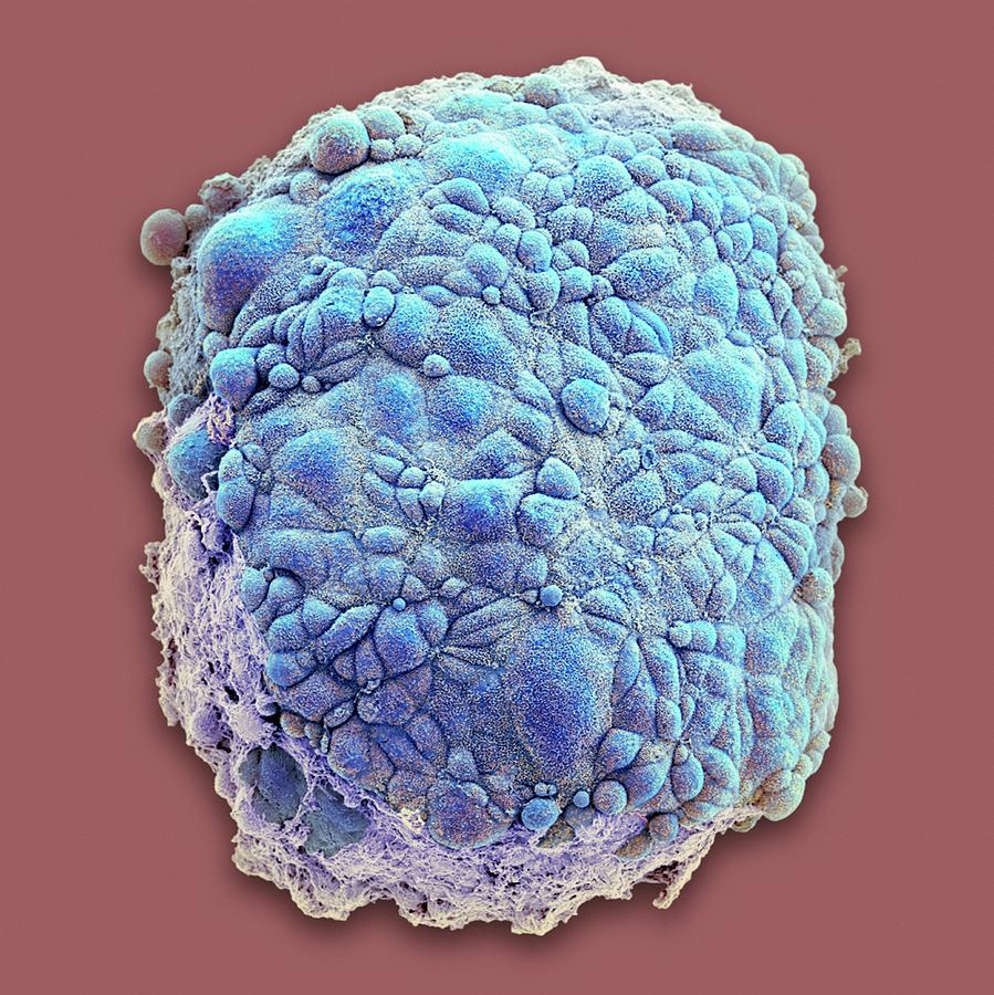 Mesothelioma Spheroid #2 Photograph by National Cancer Institute/science Photo Library