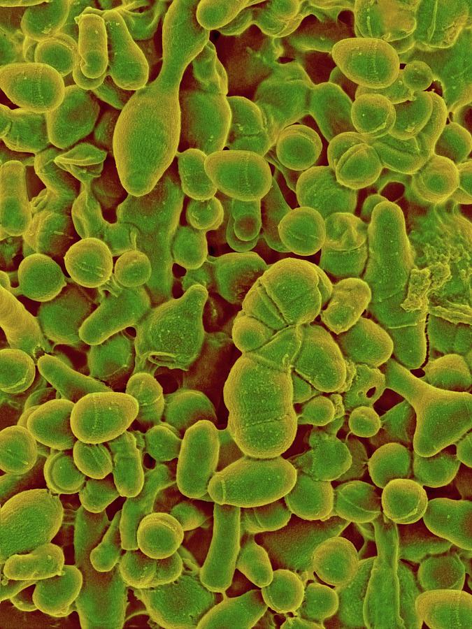 Microbacterium Kitamiense #2 Photograph by Dennis Kunkel Microscopy/science Photo Library