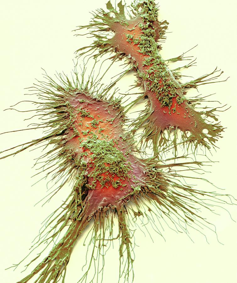 Microglia Photograph by Steve Gschmeissner