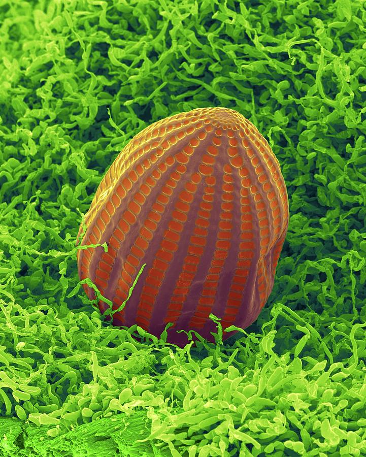 Monarch Butterfly Egg #2 Photograph by Dennis Kunkel Microscopy/science Photo Library