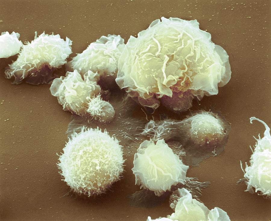 Monocyte White Blood Cells #2 Photograph by Nibsc