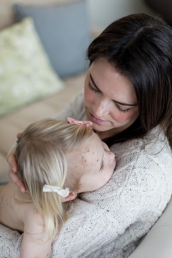 Mother And Daughter With Chickenpox #2 Photograph by Samuel Ashfield/science Photo Library