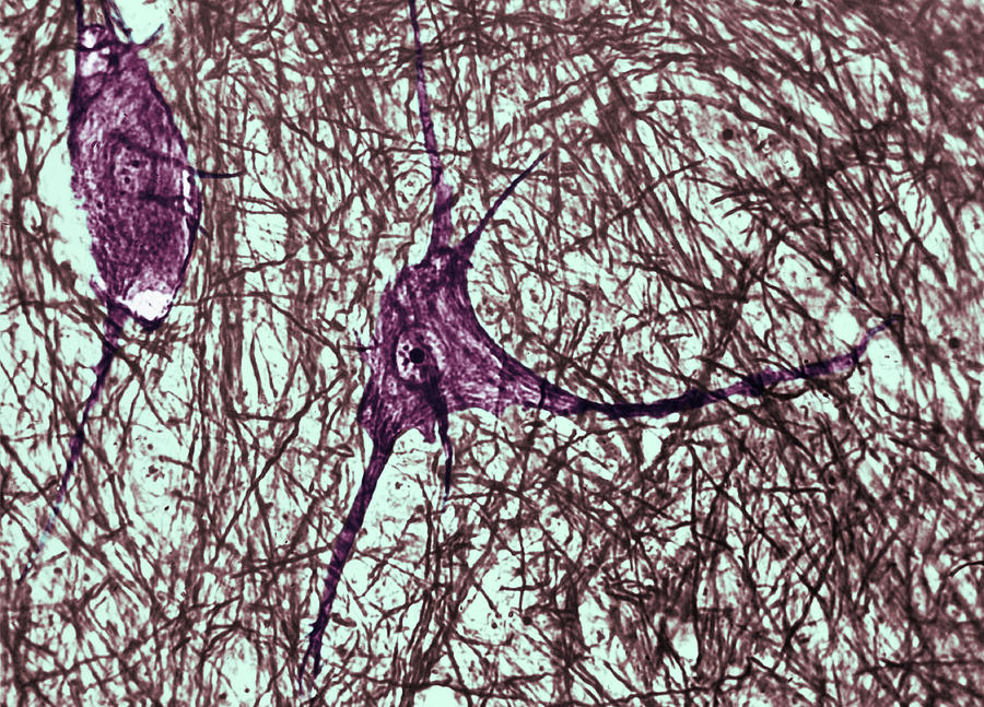 Motor Neuron, Cat Spinal Cord #2 Photograph by Omikron