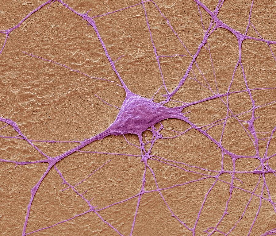 Motor Neurone #2 Photograph by Steve Gschmeissner