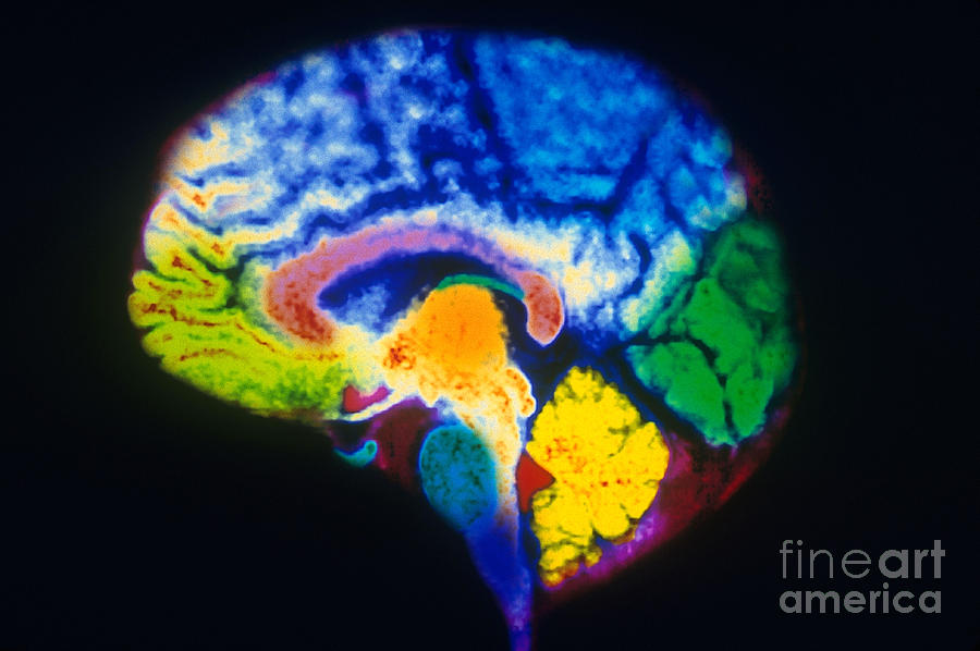 Mri Of Brain Photograph By Scott Camazine Fine Art America