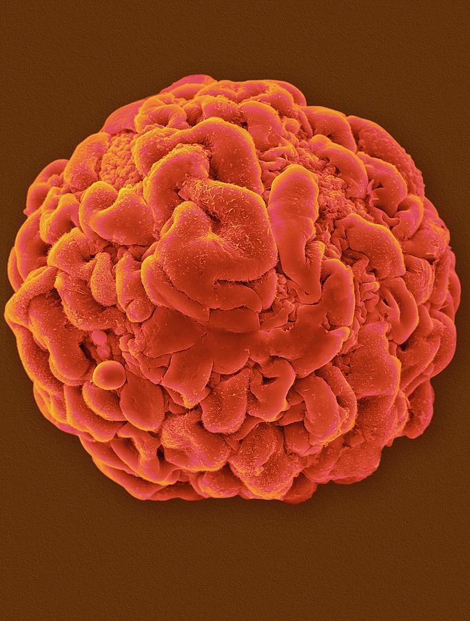 Muscle Myoblast Sphere Photograph by Dennis Kunkel Microscopy/science ...